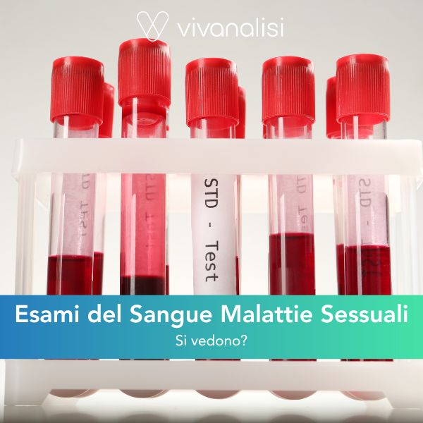 Dalle analisi del sangue si vedono le malattie sessuali