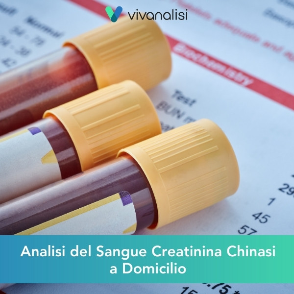 analisi del sangue creatinina chinasi a domicilio Roma