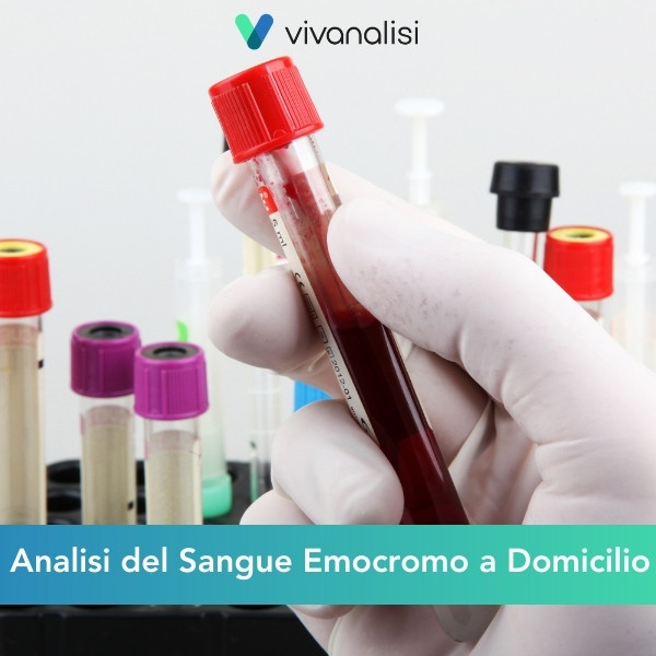 analisi del sangue emocromo a domicilio Roma