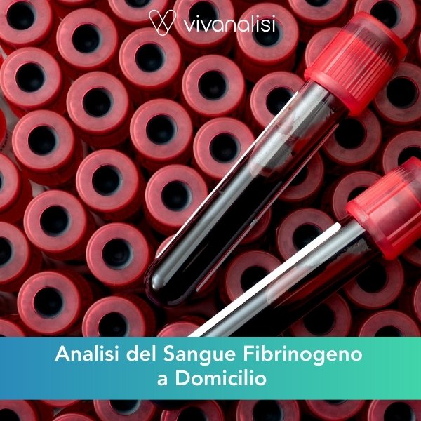 analisi del sangue fibrinogeno a domicilio Roma