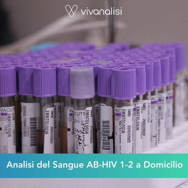 analisi del sangue AB HIV 1-2 a domicilio Roma