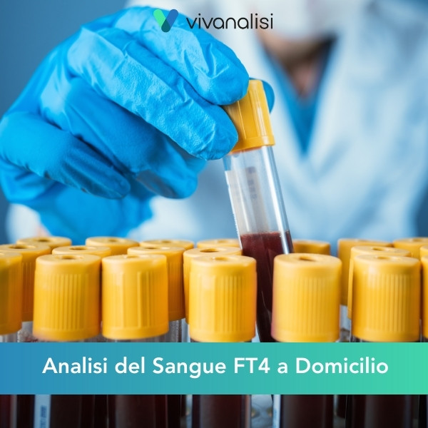 analisi del sangue ft4 a domicilio Roma