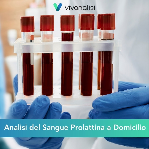 analisi del sangue prolattina a domicilio Roma