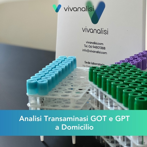 analisi del sangue transaminasi a domicilio Roma