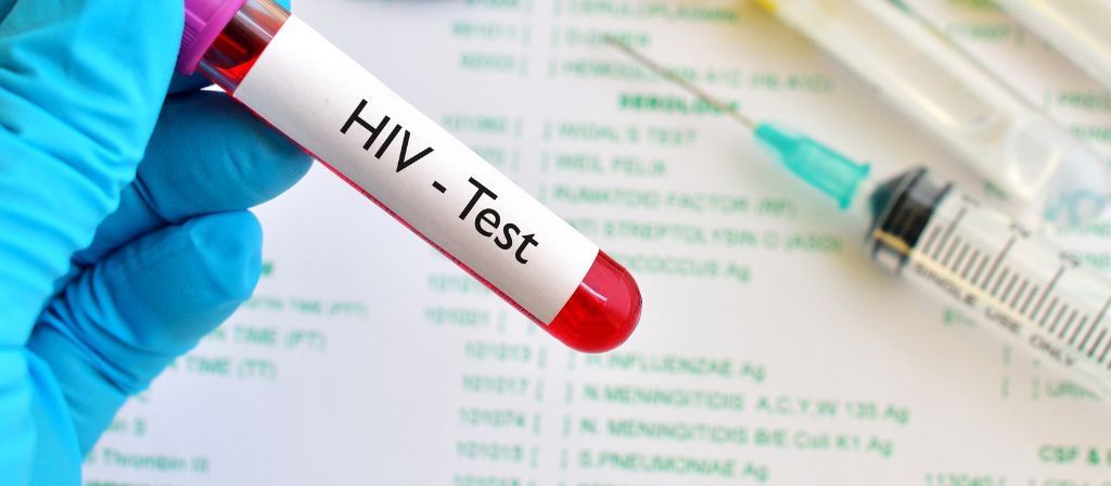 L'HIV si Vede dagli Esami del Sangue - Vivanalisi